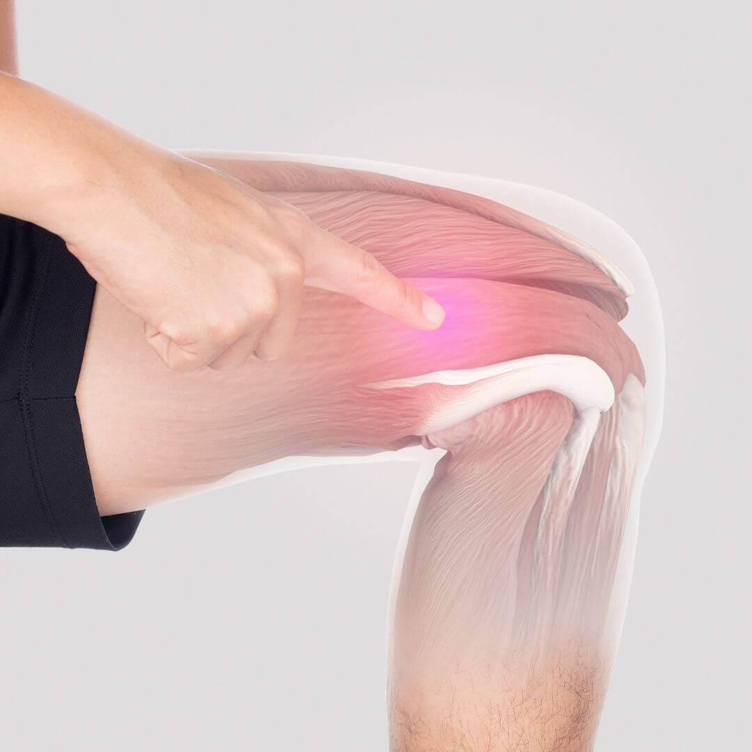 knee-pain-when-straightening-your-leg-advent-ptadvent-physical-therapy