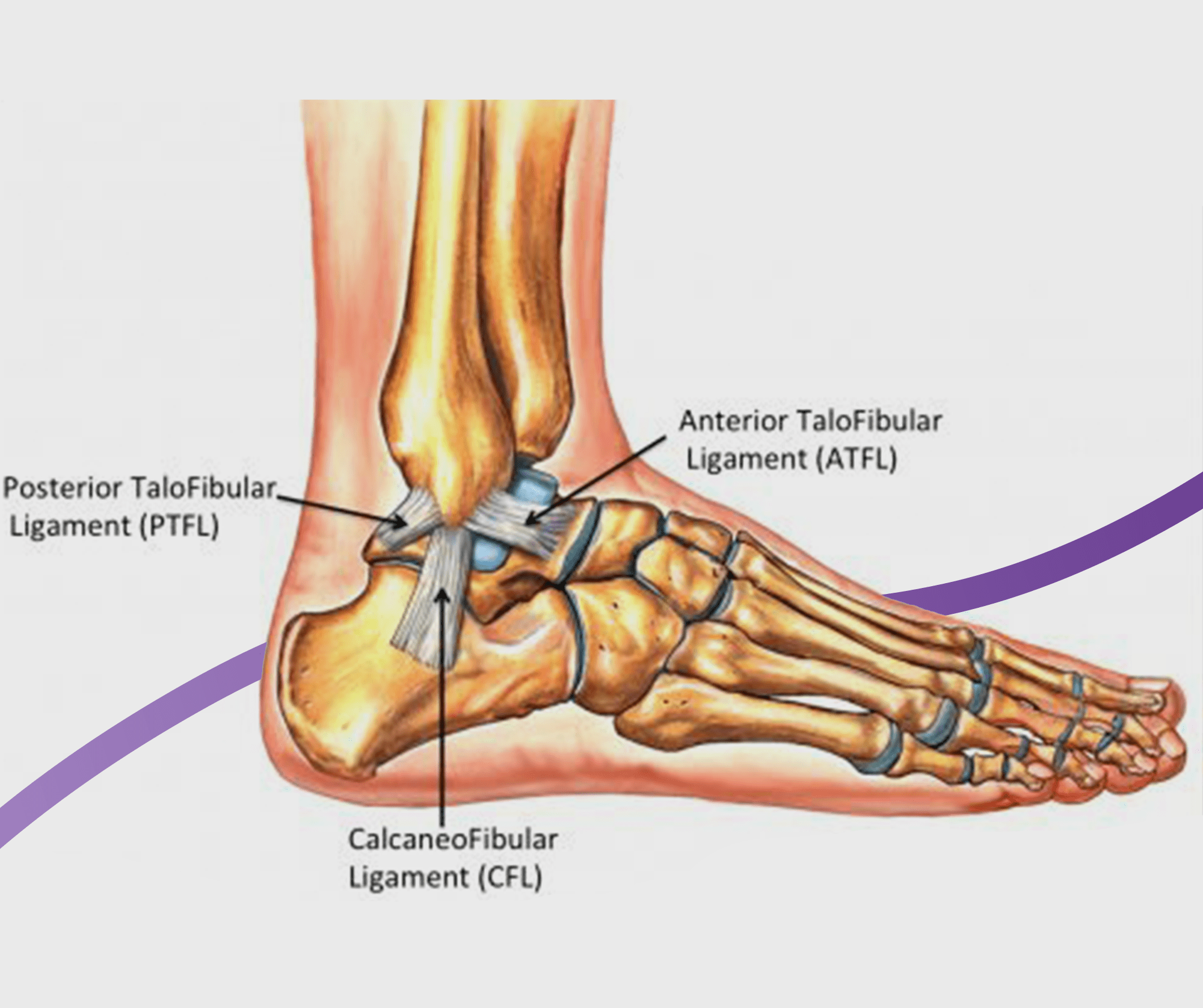 Ankle Sprains: Causes, Symptoms & Treatment