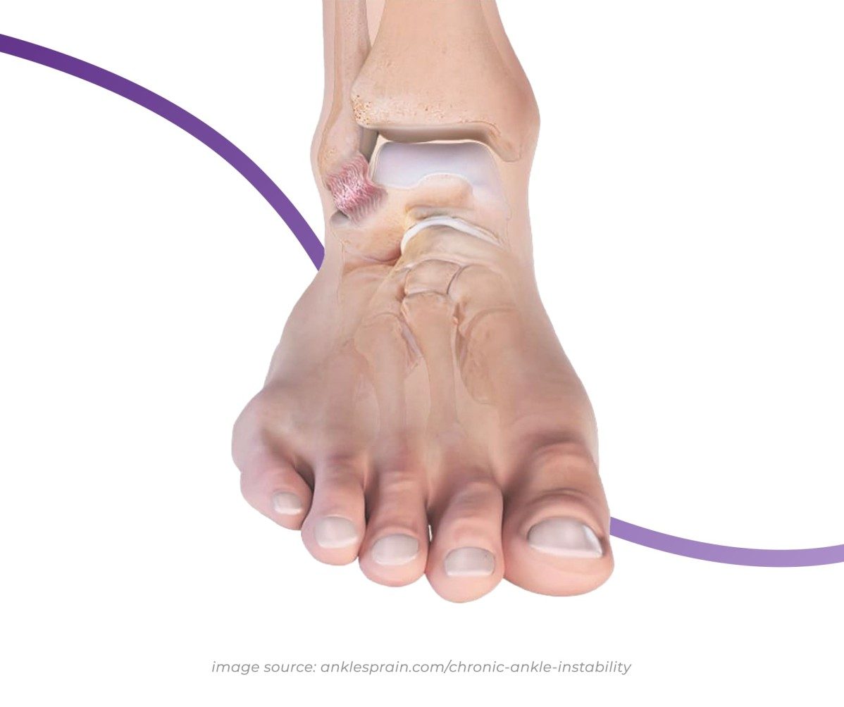 https://www.thefeetpeople.com.au/media/website_pages/symptoms-we-treat/chronic-ankle-instability/chronic-ankle-instability_1198x1004a.jpg