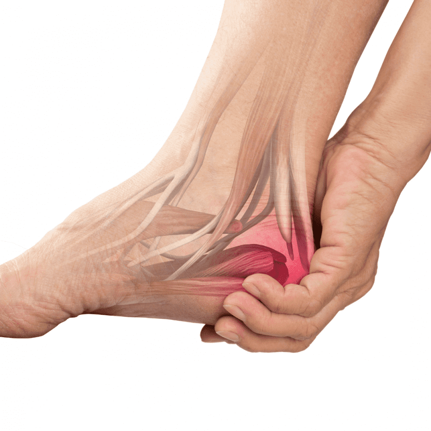 PatEdu.com : Heel Injuries and Disorders