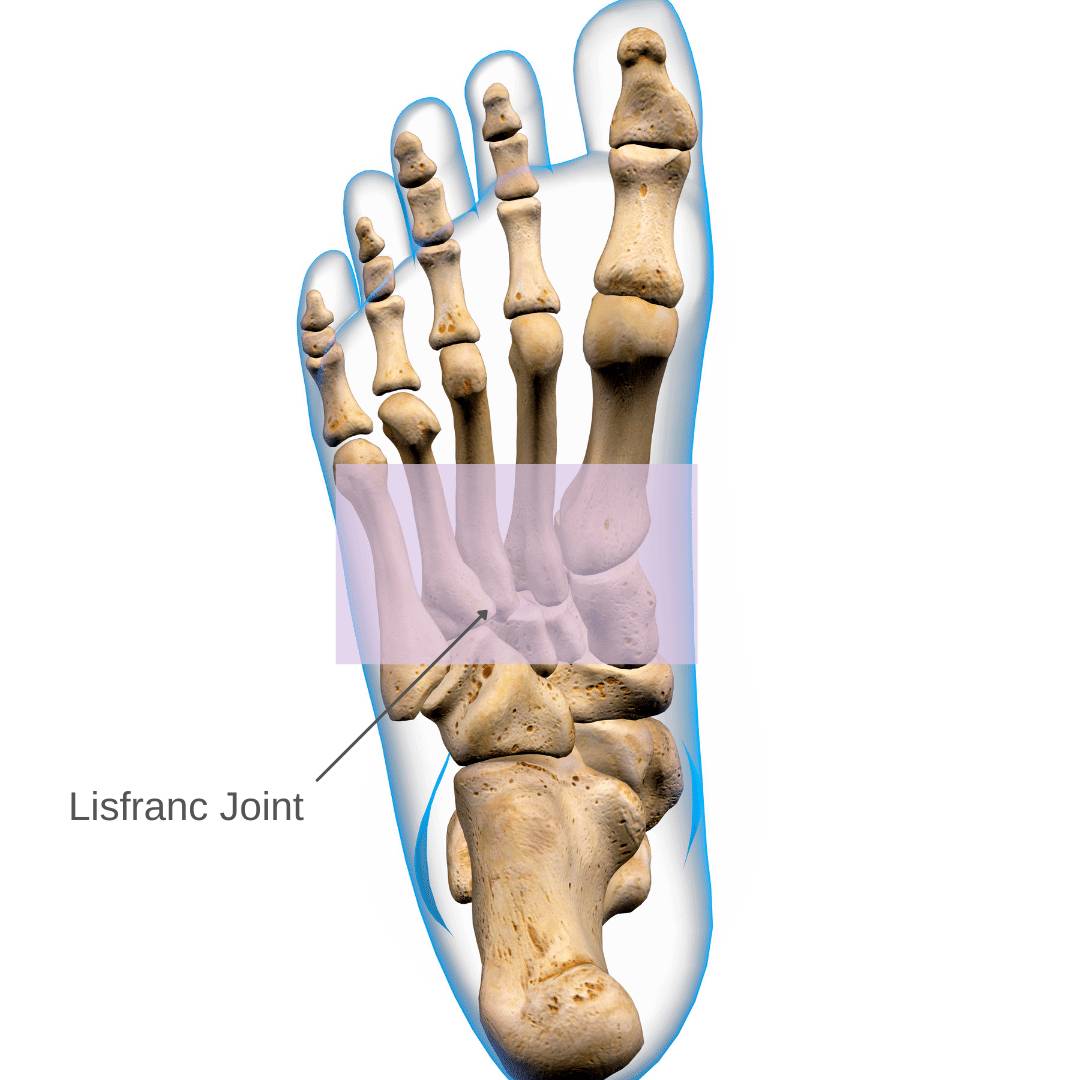 lisfranc-injury-causes-symptoms-treatment-the-feet-people-podiatry