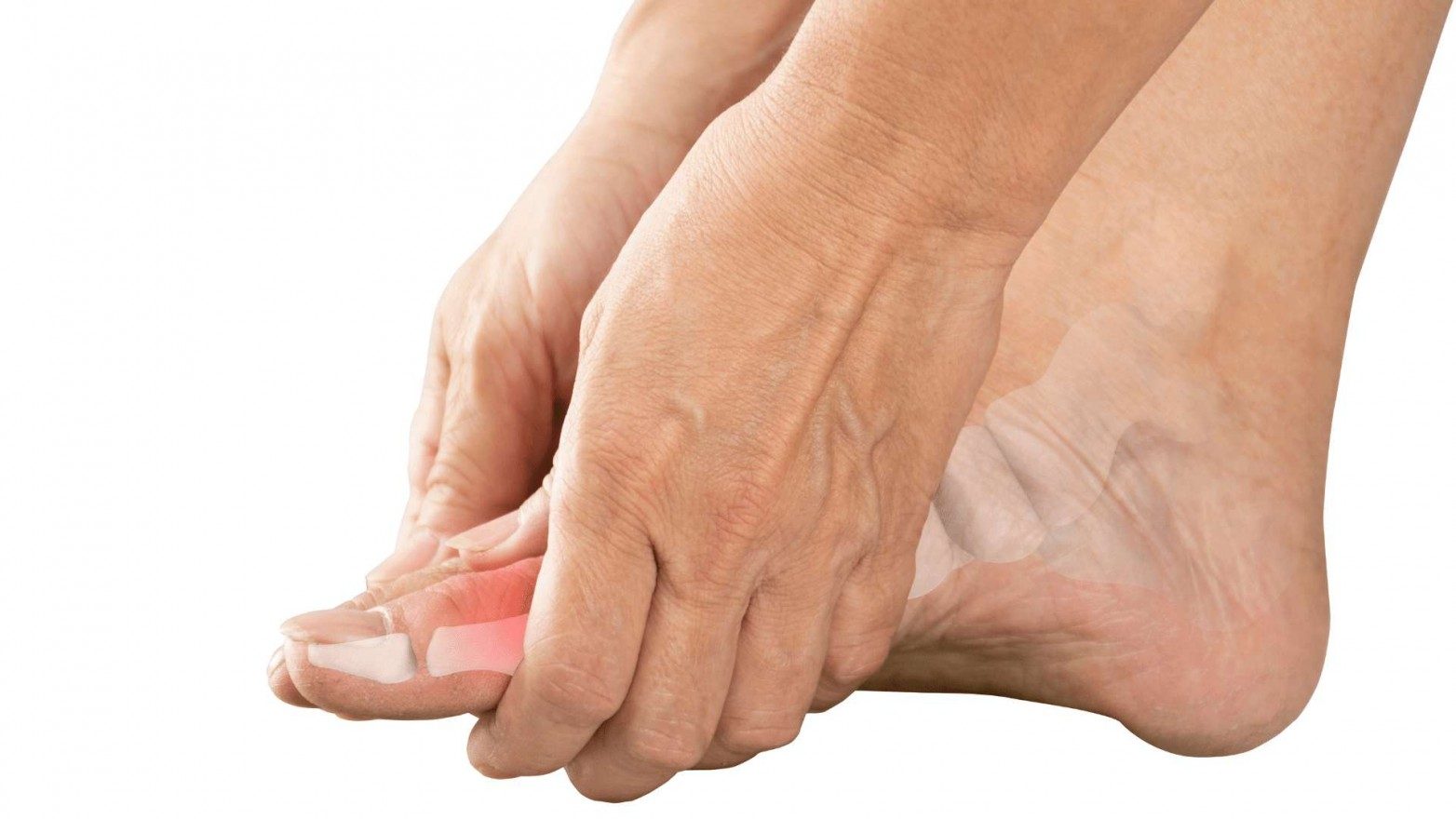 Osteoarthritis Symptoms Causes Treatment The Feet People Podiatry